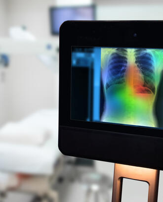 Image of lung on computer screen