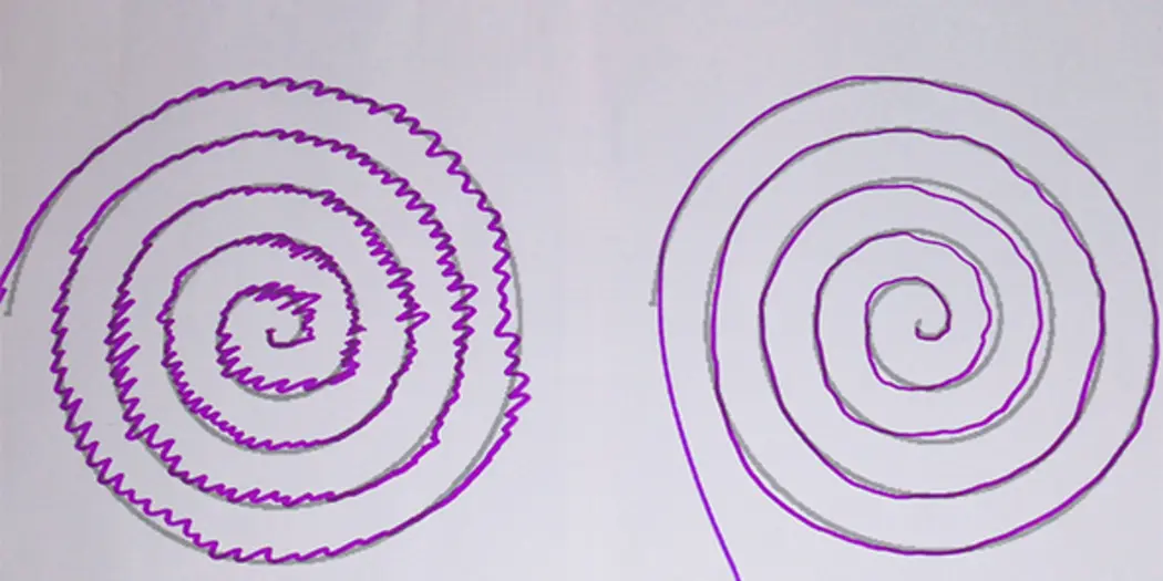 A Parkinson’s patient drew two spirals. The right one was done wearing the Animo wearable.