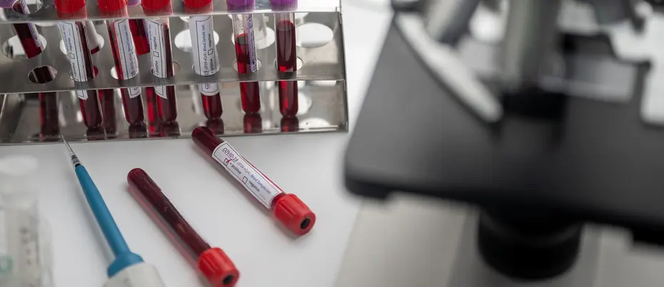 Blood test tubes and microscope