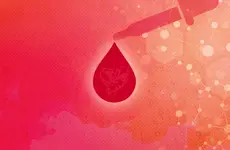 New study demonstrates early detection of lung cancer